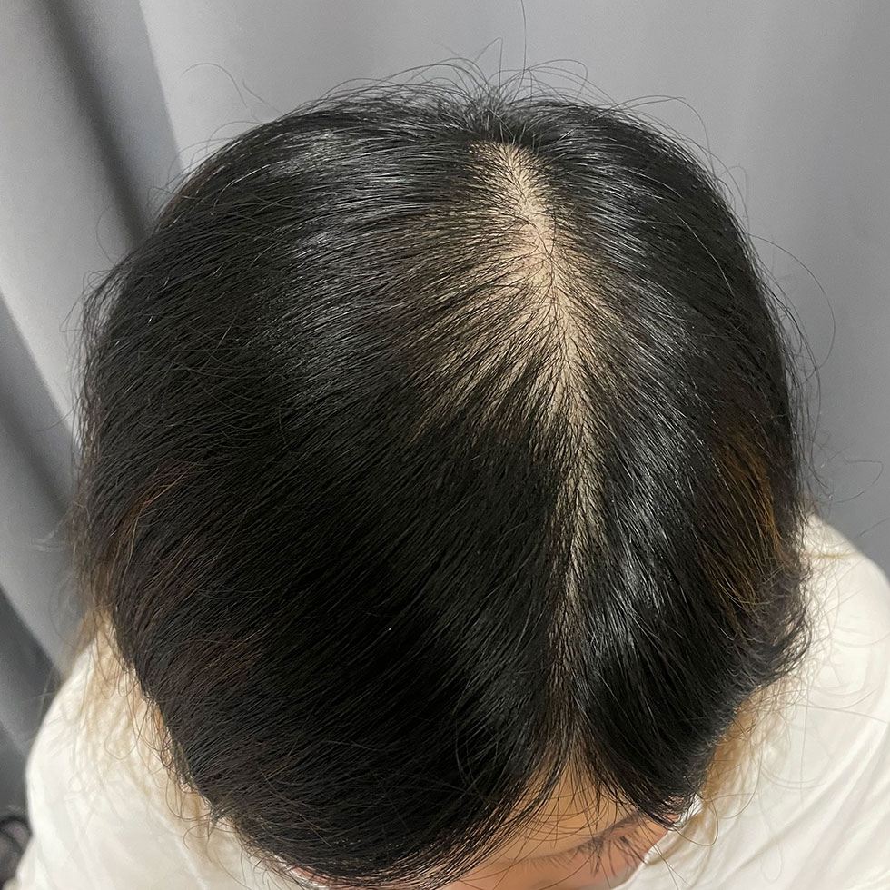 ヘアタトゥー（30代 女性）