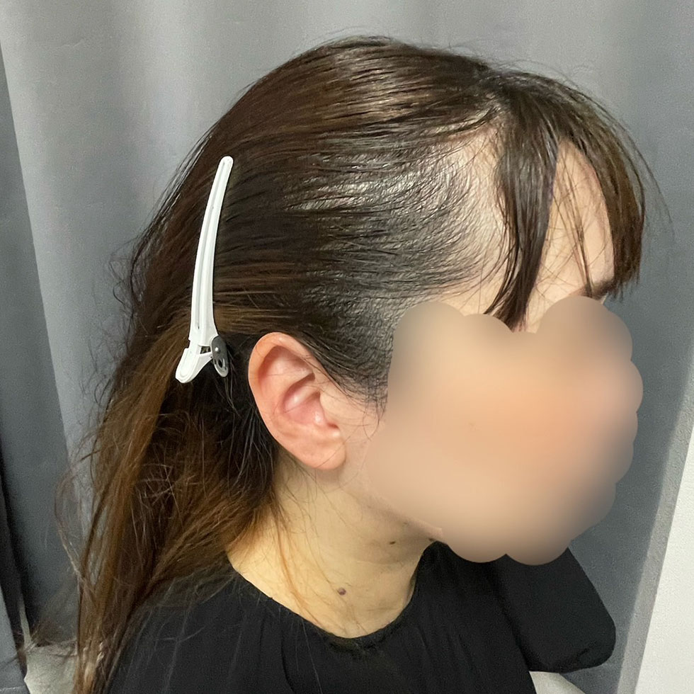 ヘアタトゥー（40代 女性）